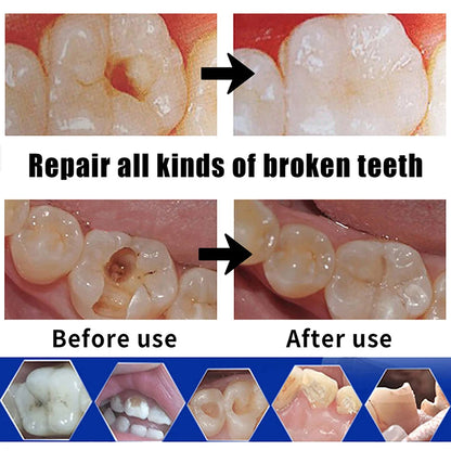 Non-toxic Falseteeth Solid Glue Set Halloween Denture Glue Vampire Dentures Scary Cosplay Fake Teeth Glue Tooth Gaps Repair Kit